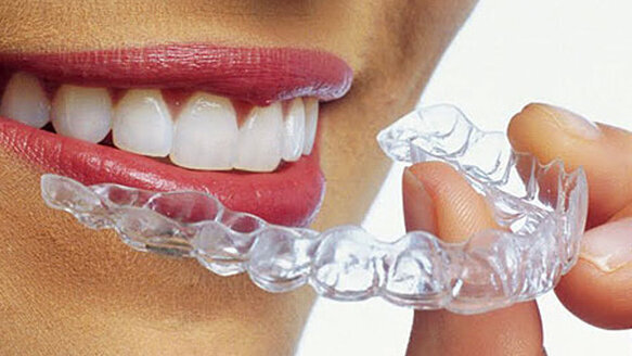 Invisalign London