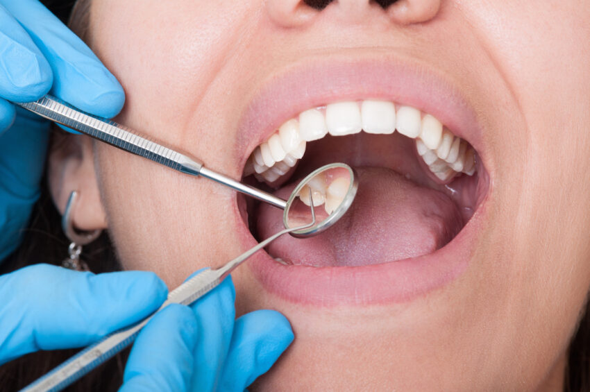 Unveiling the Secrets to Lasting Oral Health with Preventive Dentistry